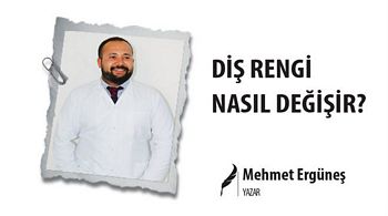 DİŞ RENGİ NASIL DEĞİŞİR?