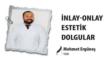 İNLAY-ONLAY ESTETİK DOLGULAR