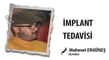 İMPLANT TEDAVİSİ